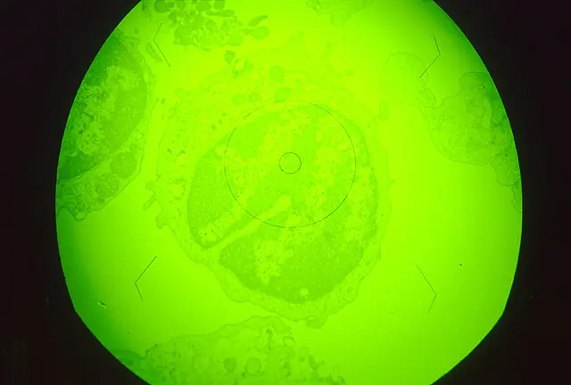 African swine fever infected macrophage
